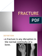 Fracture