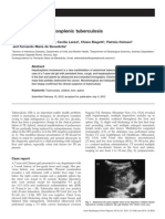 Macronodular Hepatosplenic Tuberculosis: Case Report