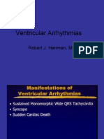 Ventricular Arrhythmias: Robert J. Hariman, MD