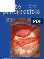 Acute Pancreatitis