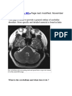 Cerebellar Disorders