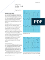 Acute Myocardial Infarction-Part II: ABC of Clinical Electrocardiography