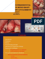 Non-Bone Graft Associated Regenerative Periodontal Therapy