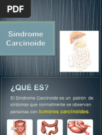 Sindrome Carcinoide