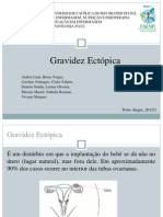 Gravidez Ectópica