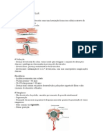 Doença Diverticular