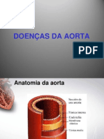 DOENÇAS Da AORTA e Do PERICÁRDIO