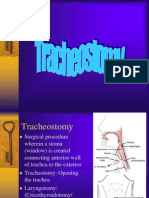 Tracheostomy 2