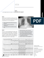 062 Cerebral-Challenge 5 Update 2011 PDF