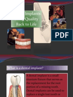 Implant Introduction