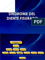 Síndrome Diente Fisurado