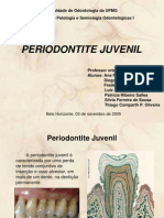 Periodontite Juvenil