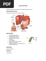COLECISTECTOMIA