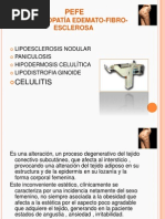 Celulitis y Homotoxicologia