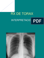 Interpretacion de Radiografias Toracicas