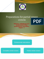 Preparations For Partial Veneer Crowns