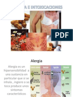 Alergia e Intoxicaciones