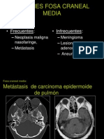 Lesiones de La Fosa Craneal Media