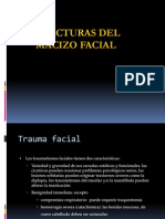 Fracturas Faciales