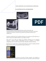 Clasificación de Las Áreas Edéntulas y Las Características Anatómicas de Ellas