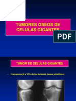 12 - Tumor de Celulas Gigantes