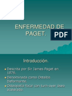 Enfermedad de Paget