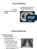 Pneumothorax