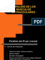 Paralisis de Musculos Extraoculares