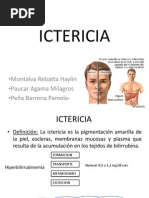 Ictericia de Origen Maligno