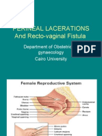 Perineal Lacerations & Rec To Vaginal Fistula