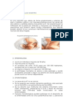 Arteritis de Celulas Gigantes