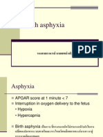 Birth Asphyxia