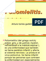 Poliomielitis