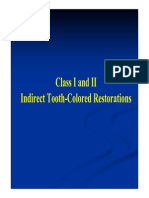 Class I and II Indirect Tooth-Colored Restorations (4,5)