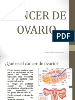 Cáncer de Ovario