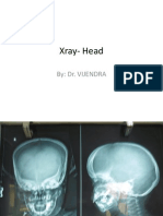 Xray Head