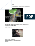 Eponymous Signs in ENT