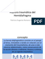 Hernia Diafragmática