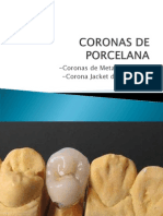 Coronas de Porcelana 2unid