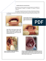 Examen Clínico de La Mucosa Bucal