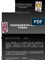 Radiología de Torax