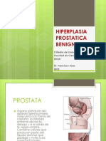 Hiperplasia Prostatica Benigna