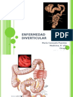 Enf Diverticular