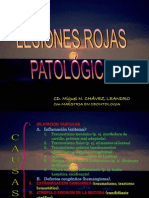 Lesiones Rojas