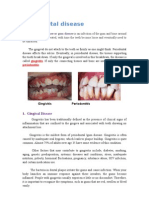 Periodontal Disease