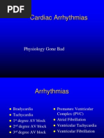 Arrhythmias