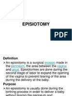 Episiotomy