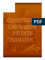 Classification of Carious Lesions and Tooth Preparation