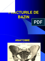 Fracturile de Bazin