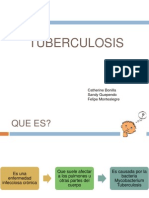 Caso Clinico Tuberculosis